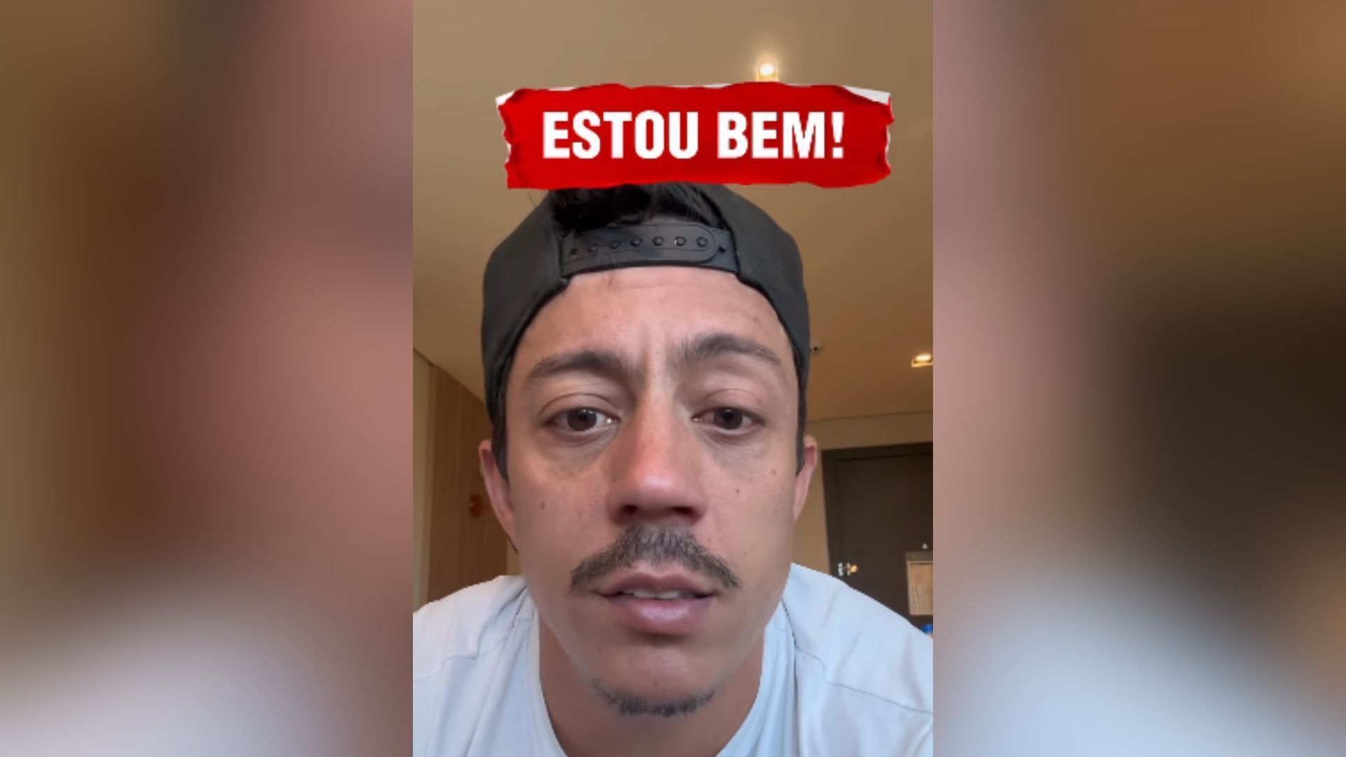 Paralisia de Bell: famosos que enfrentaram a condição com coragem