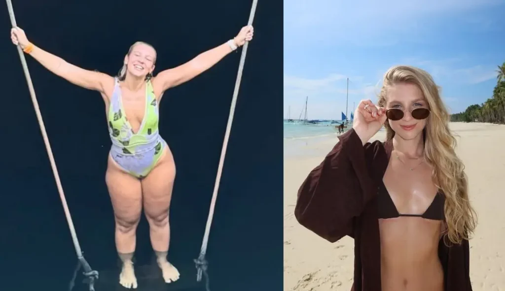 Lauren Pfeiff relata um ano de cirurgia de lipedema: Resultados positivos