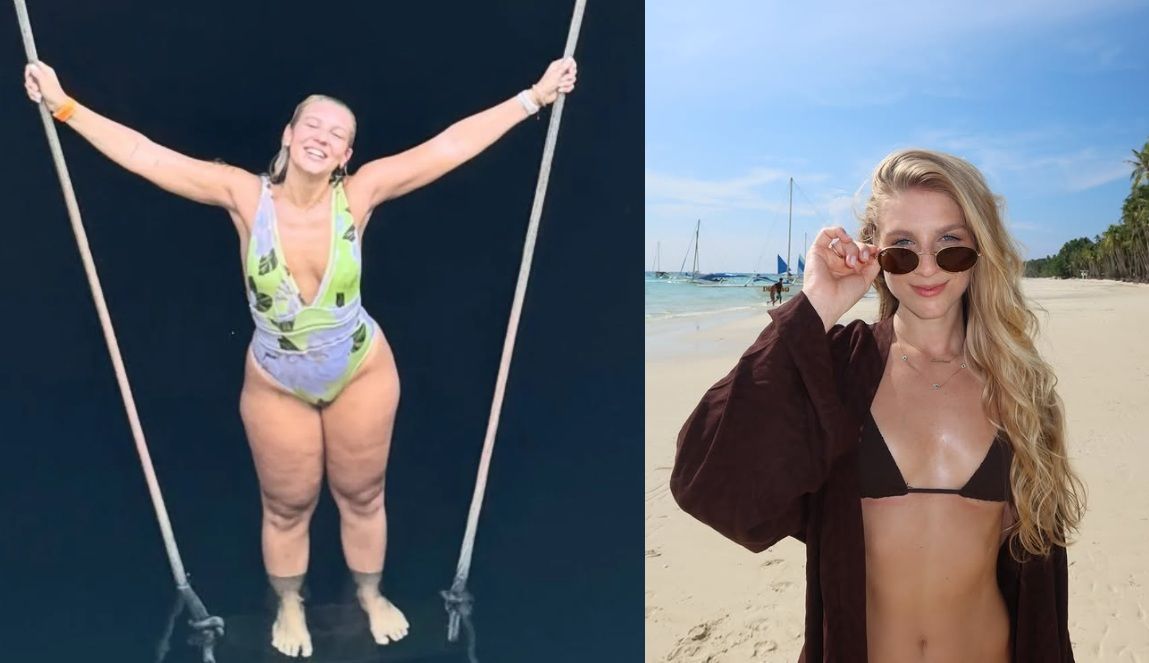 Lauren Pfeiff relata um ano de cirurgia de lipedema: Resultados positivos